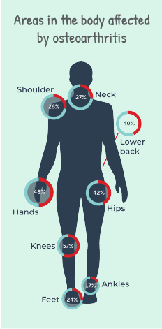 JointHealth Insight